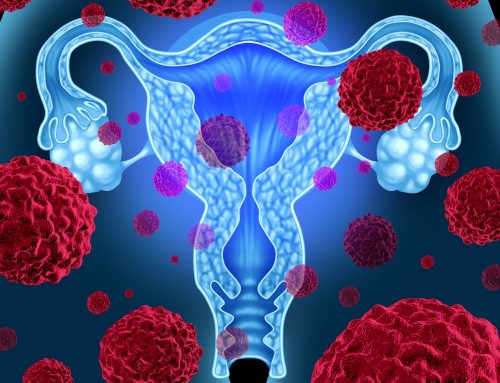 An Exploration of Polycystic Ovary Syndrome and Its Connection To Health Issues
